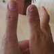 Illustration for article titled Owner Claims $225K Bentley Did This To His Wife's Thumb